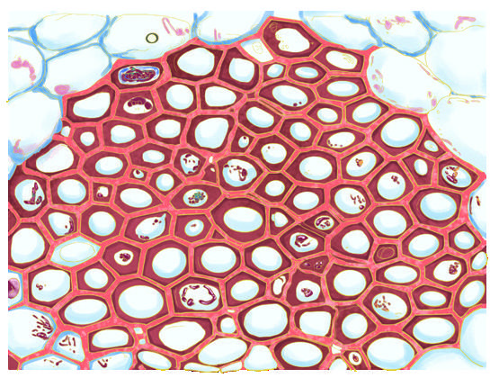Sclerenchyma cells, thick lignified walls